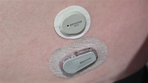 How Long Can You Swim with Dexcom G7: Exploring the Depths of Continuous Glucose Monitoring